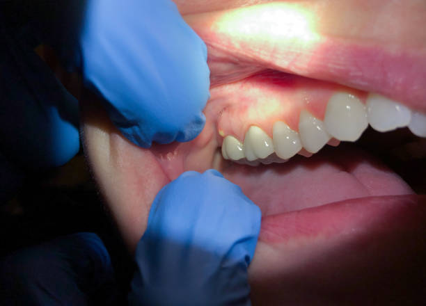 Best Knocked-Out Tooth Emergency  in Westville, OK